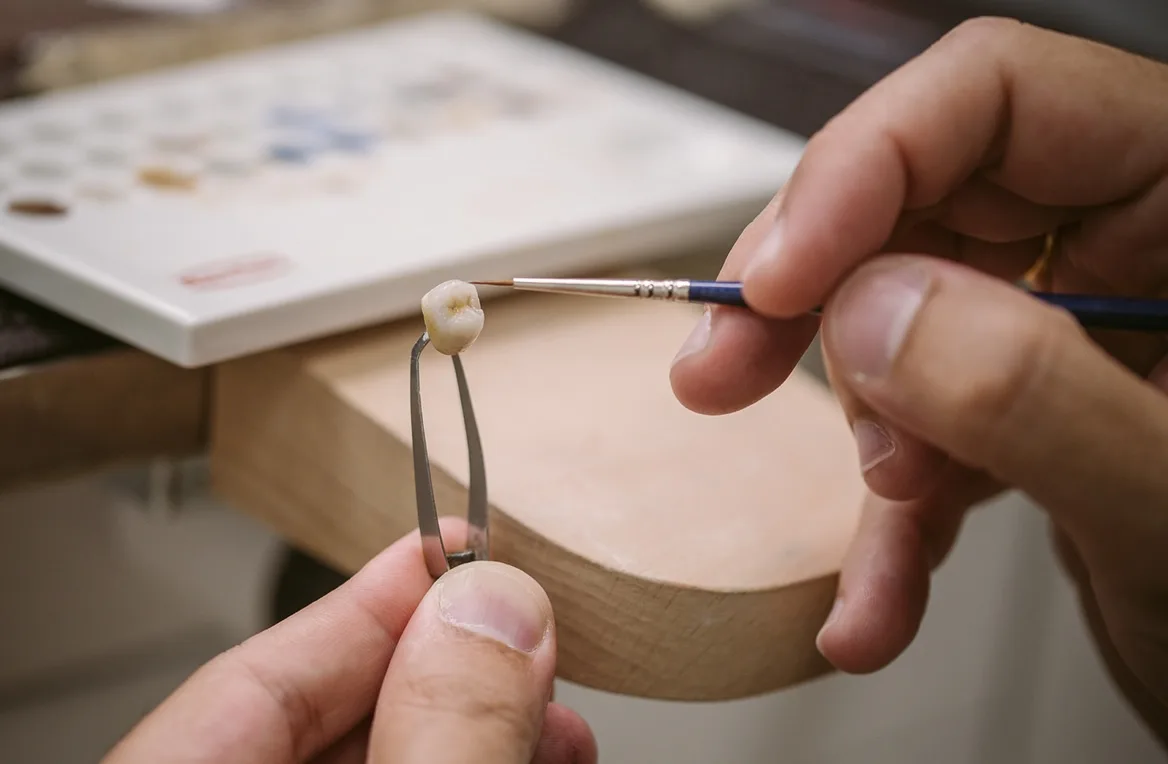 prótesis dentales en laboratorio especializado