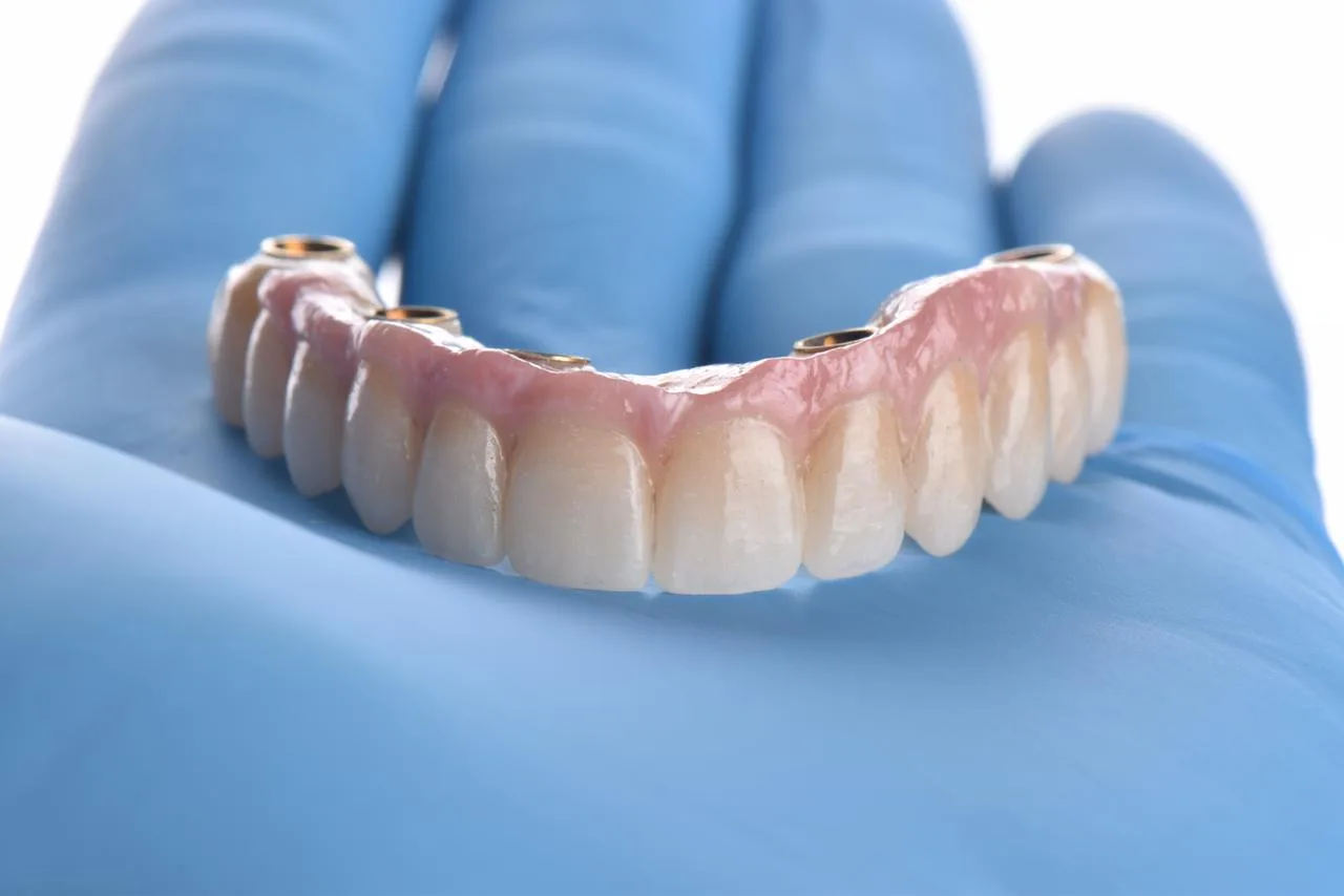 Foto de prótesis sobre guante